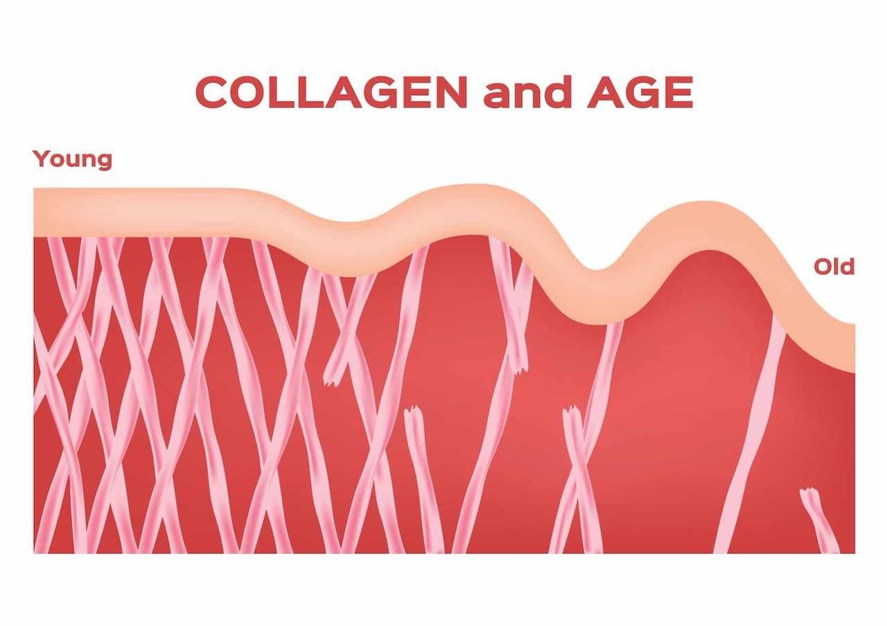 Kesan glycation pada kolagen dan elastin